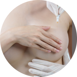 Увеличение груди